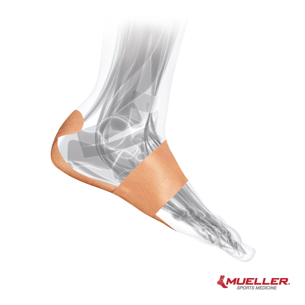 ミューラー 足底筋膜サポートテープ