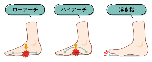足裏のトラブル